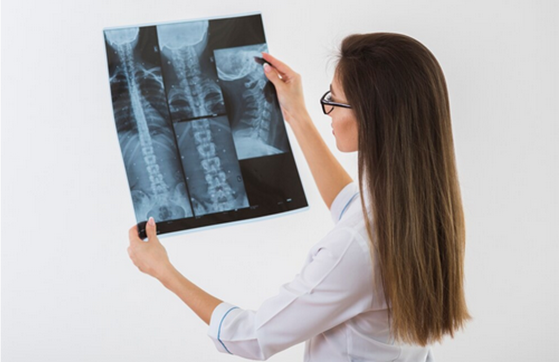 Equipo de Rayos X convencional rápido y digital o Radiografías de tórax con interpretación por especialista.